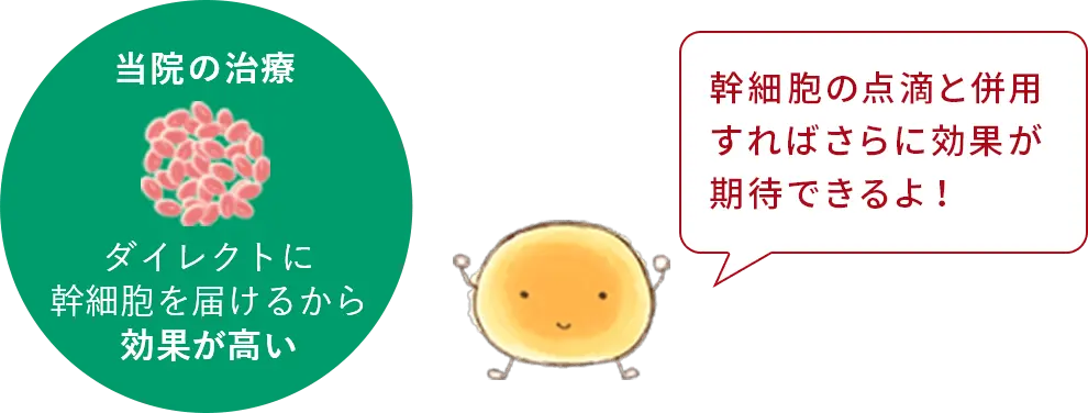 当院の治療:ダイレクトに幹細胞を届けるから効果が高い