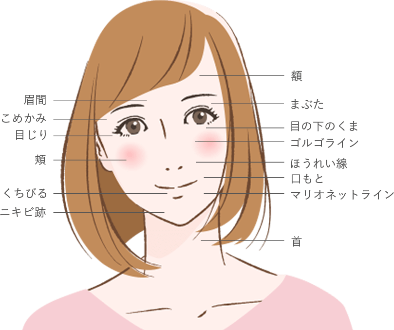 イラスト：幹細胞による肌再生医療が適応となる箇所