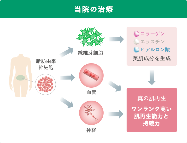 当院の治療：ワンランク高い肌再生能力と持続力