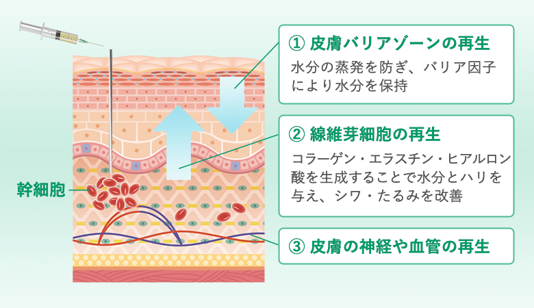 バランスが崩れると脂肪がたまっちゃうよ…