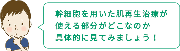 幹細胞を用いた肌再生治療が使える部分がどこなのか具体的に見てみましょう！