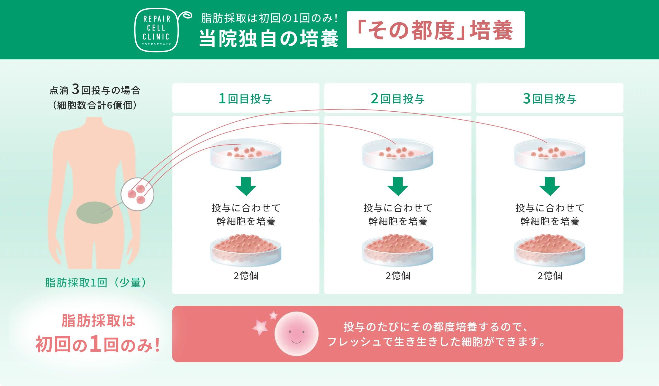 脂肪採取は初回の1回のみ！当院独自の培養「その都度」培養