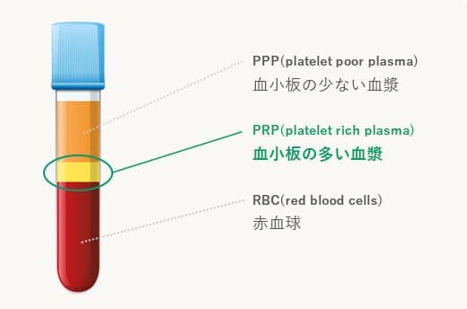 PRPは血小板の多い血漿